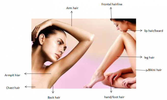 Full Body Facial Hair Removal Laser Machine Permanent Hair