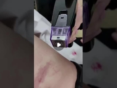 50W Fractional RF Microneedle Machine 100V To 240V