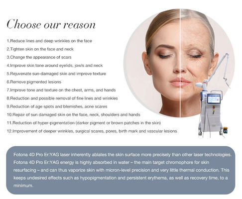 1064nm Nd Yag Laser Machine Fractional Laser Skin Resurfacing Scar Removal